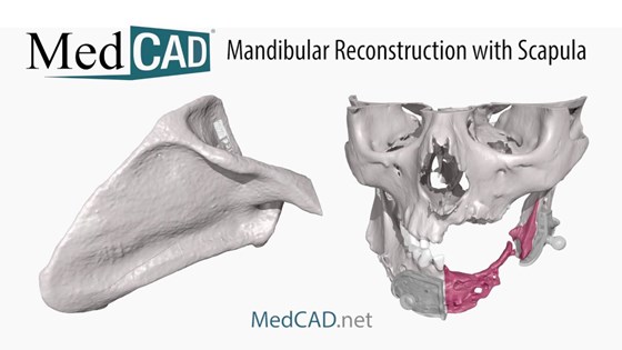 MedCAD: Gallery